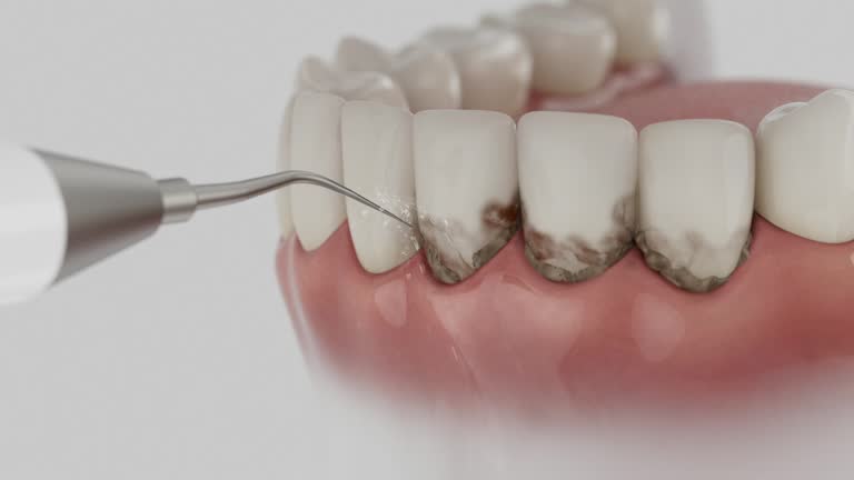 Reliable Teeth Cleaning And Checkup contractor in Forrest County County, MS by Dentist Open Now